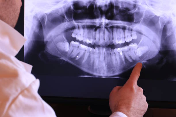 Best Emergency Dental Care for Broken or Chipped Teeth in Cuyahoga Falls, OH